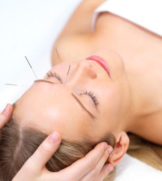 AC Acupuncture Kingston
